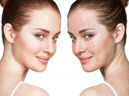 Beauty Age Skin - come si usa - ingredienti - composizione - funziona